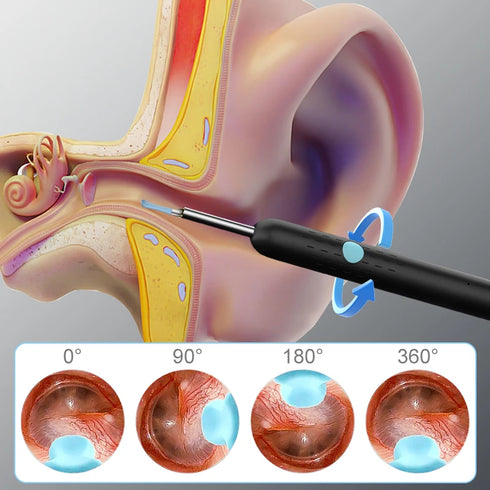 WIFI Visual Ear Sticks HD1080P 4.2MM Mini Camera Ear Pick Ear Spoon Ear Cleaner Wireless Endoscope Health Care Ear Wax Cleaning