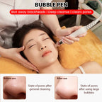 6in1 Dermabrasion Peel Spa Facial Rejuvenation Machine Skin Rejuvenation Hydro Dermabrasion Aqua Deep Cleansing Skin Care Device