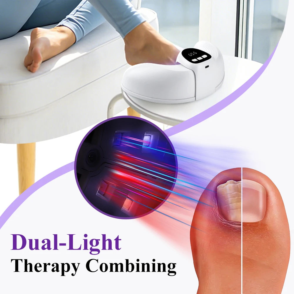 Household Fungal Nail Laser Device Wireless Foot Repair Toenail Fingernail Anti Fungus Infection Paronychia Onychomycosis Care